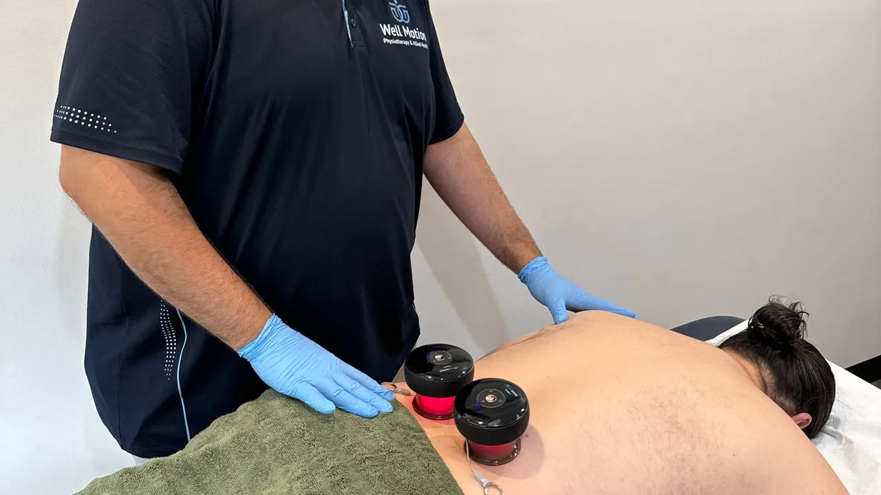 Ahmed Elsayed treating a male patient’s back with dynamic cupping devices